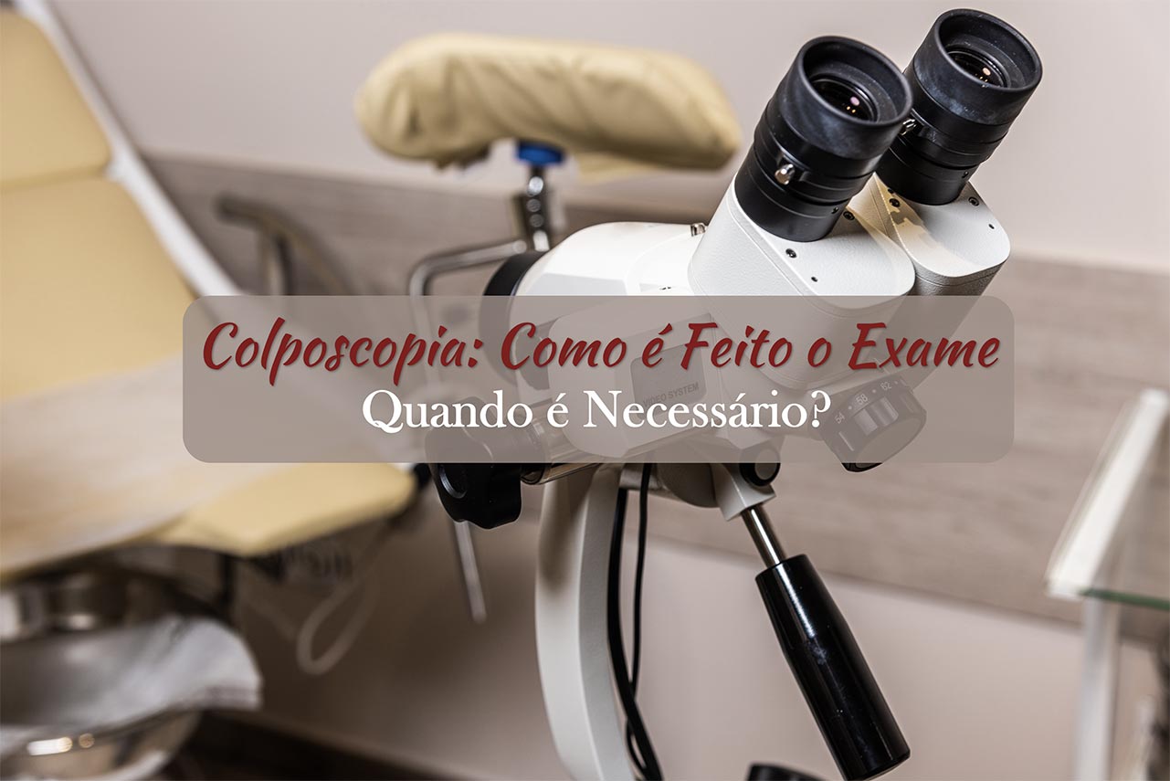 Colposcopia: Como é Feito o Exame e Quando é Necessário?