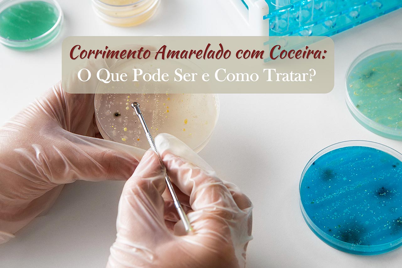 Corrimento Amarelado com Coceira: O Que Pode Ser e Qual o Melhor Tratamento?