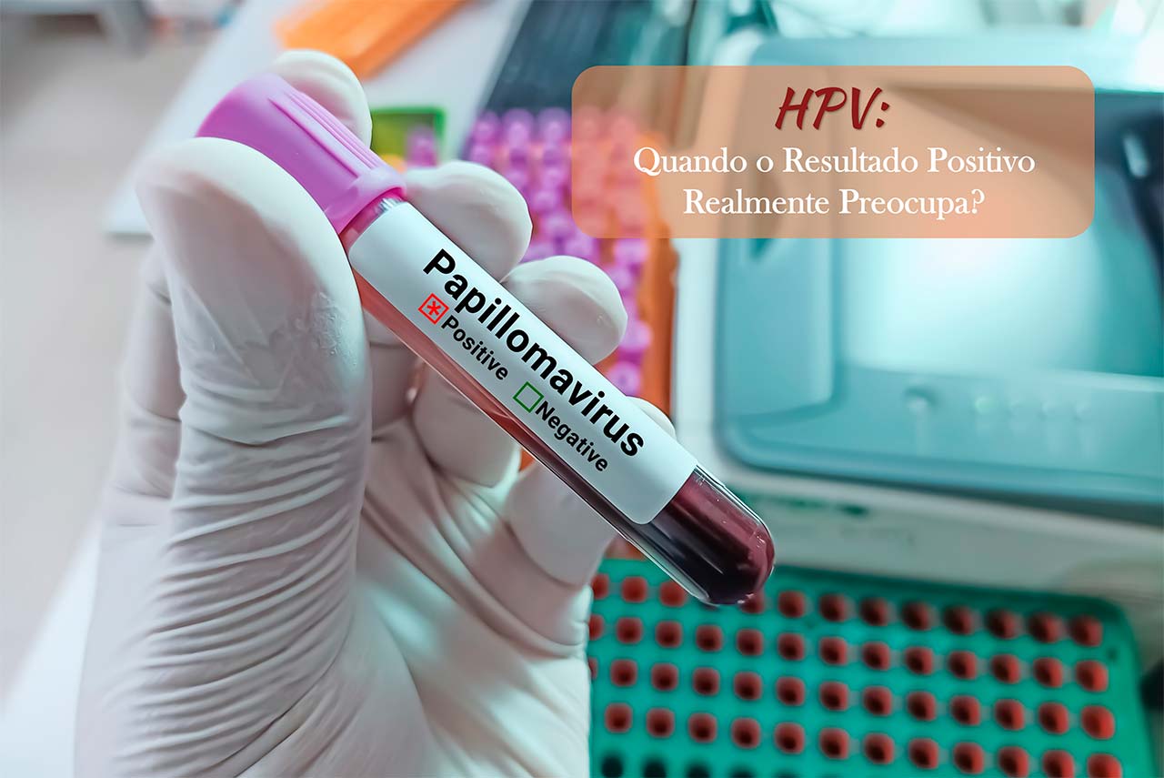 HPV: Quando o Resultado Positivo Realmente Preocupa?