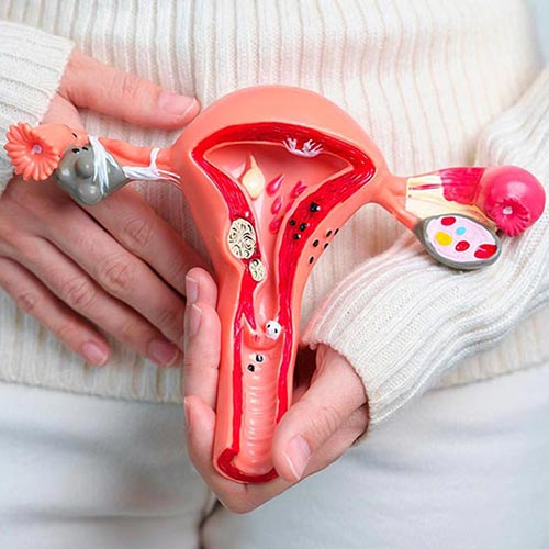 Cauterização - Ginecologista em Vitória - Espírito Santo, colposcopia e laser ginecológico.