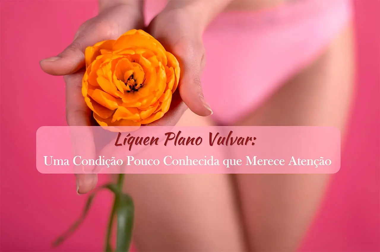 Líquen Plano Vulvar: Uma Condição Pouco Conhecida que Merece Atenção