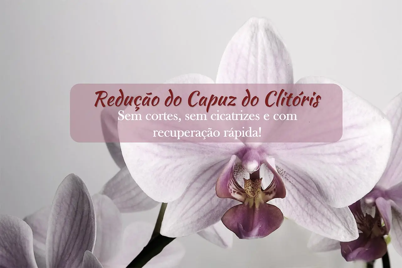 Redução do Capuz do Clitóris sem Cortes: Técnica Inovadora